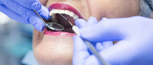 Best Emergency Treatment for Dental Infections or Abscesses in Coplay, PA